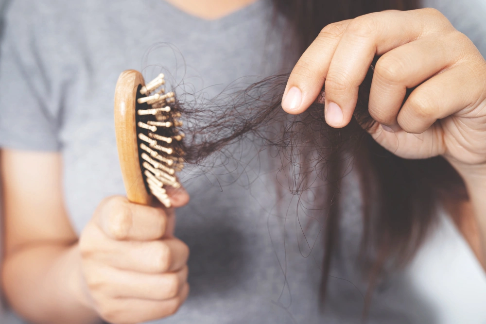 alopecia areata hair loss patches